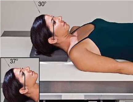 Metodo-de-Towne-Incidencia-AP-axial-anteroposterior-do-crânio.