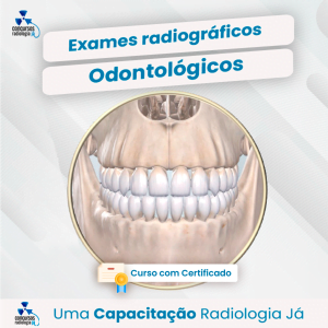 Exames Radiográficos Odontológicos.
